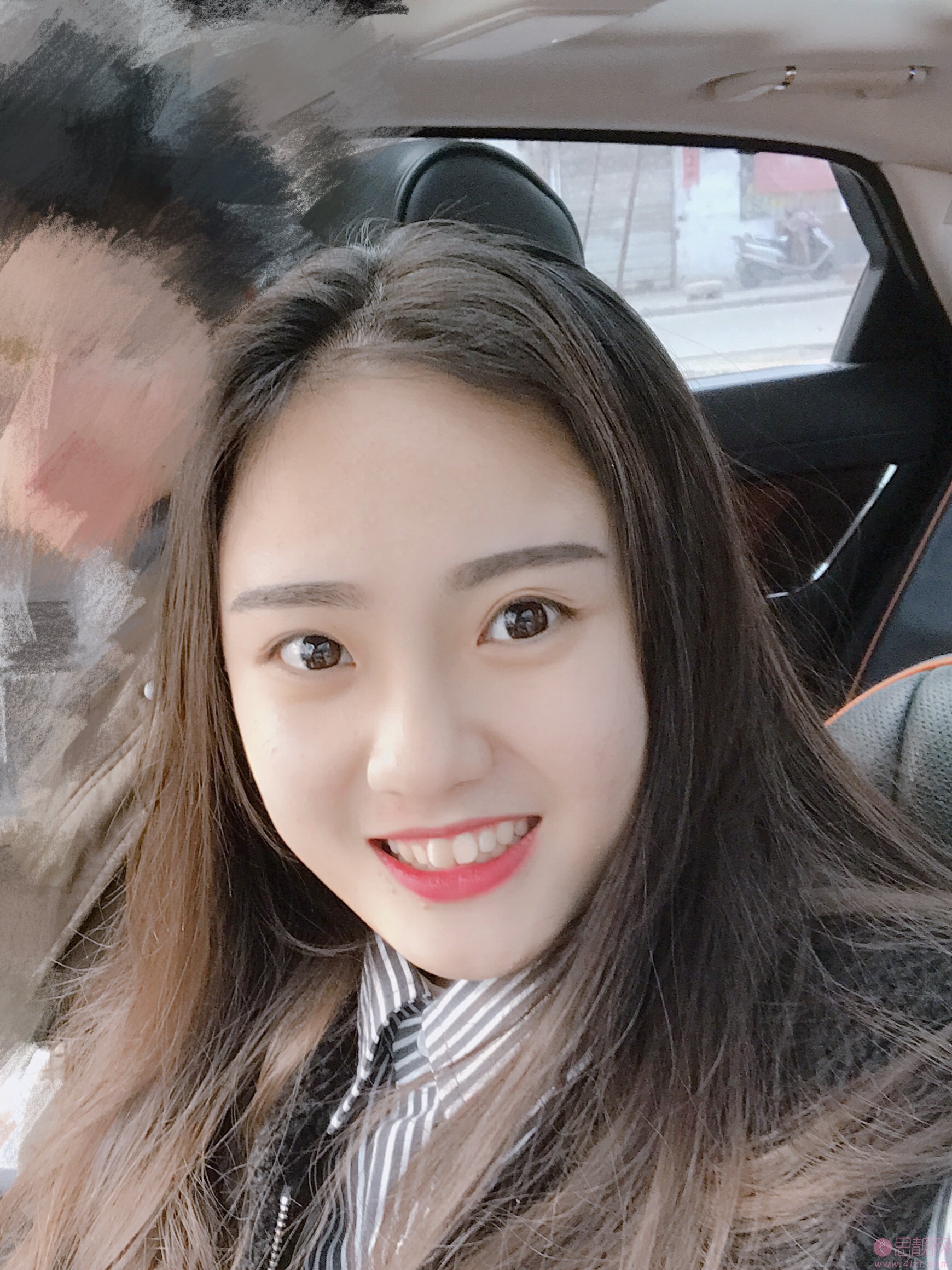 拜博口腔和维乐口腔哪个好？附牙齿矫正真人案例一览