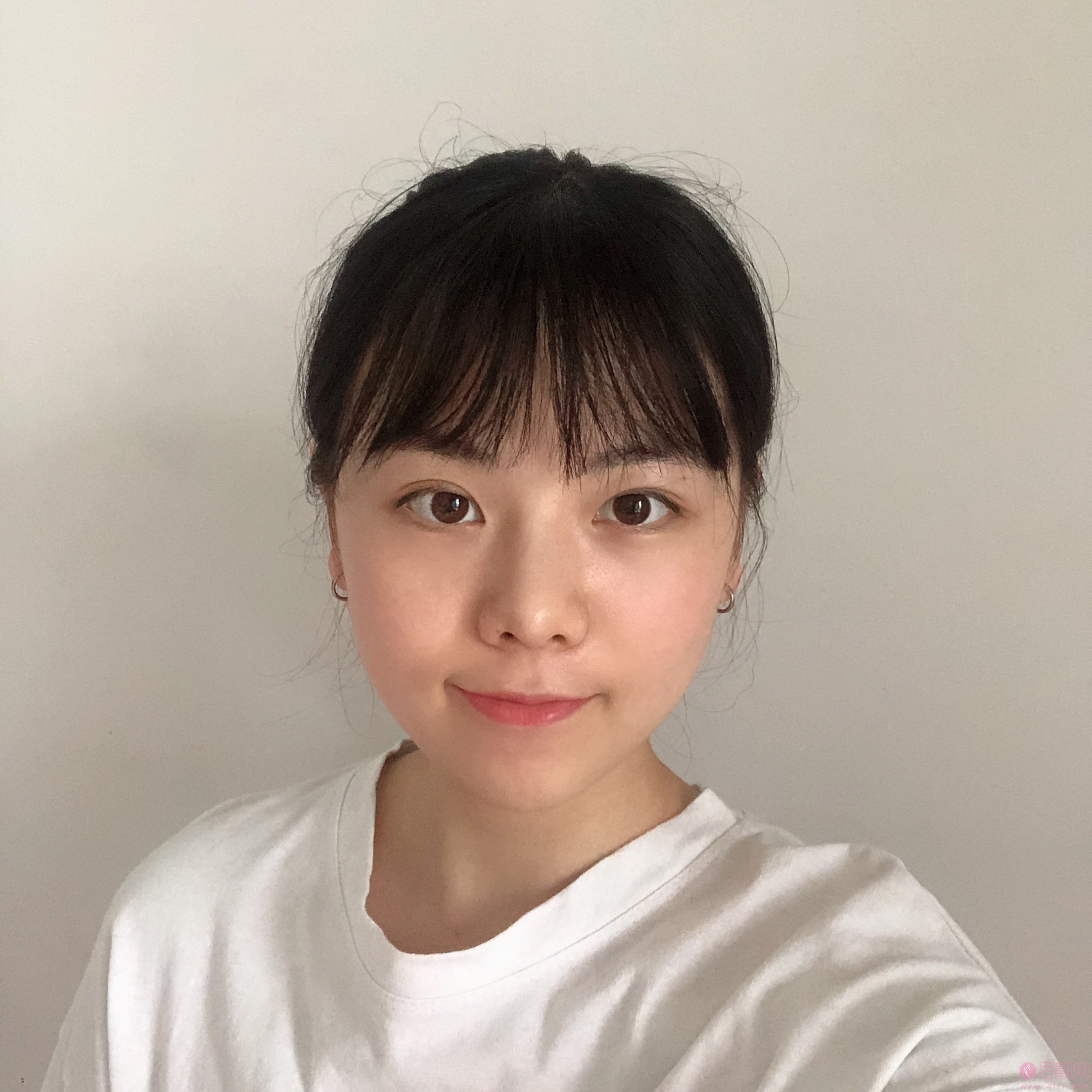 滨州医学院附属医院激光美容科嫩肤怎么样?附2020价格表曝光