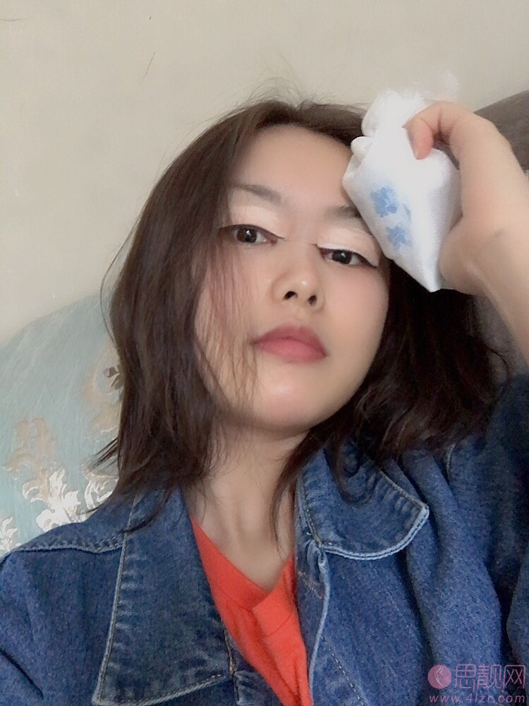 成都西区医院车红昌做双眼皮手术怎么样？附双眼皮案例一览及2020价格表曝光