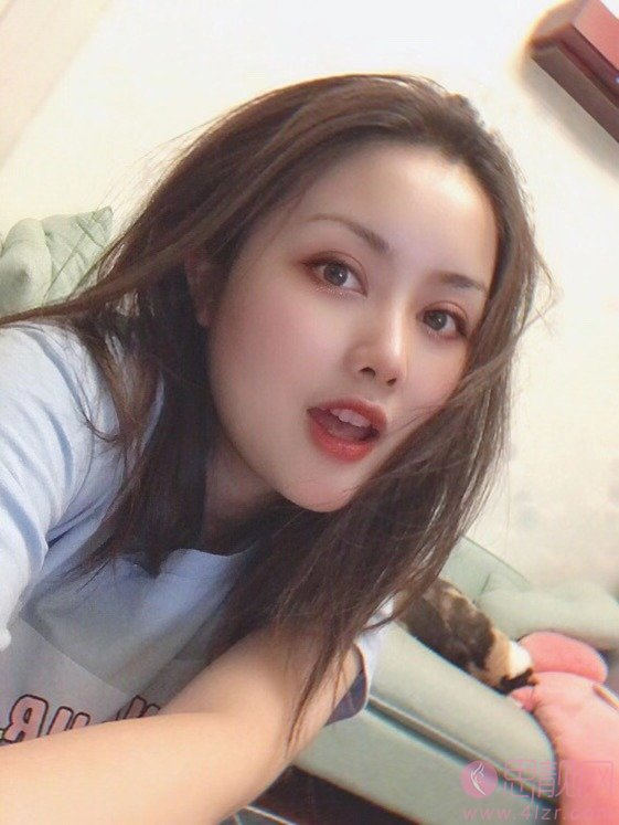 成都西区医院车红昌做双眼皮手术怎么样?附双眼皮案例一览及2020价格表曝光