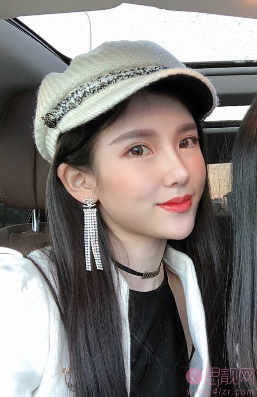 成都仪美美仁周仪做肋骨鼻怎么样？附隆鼻真人反馈及2020价格表公开