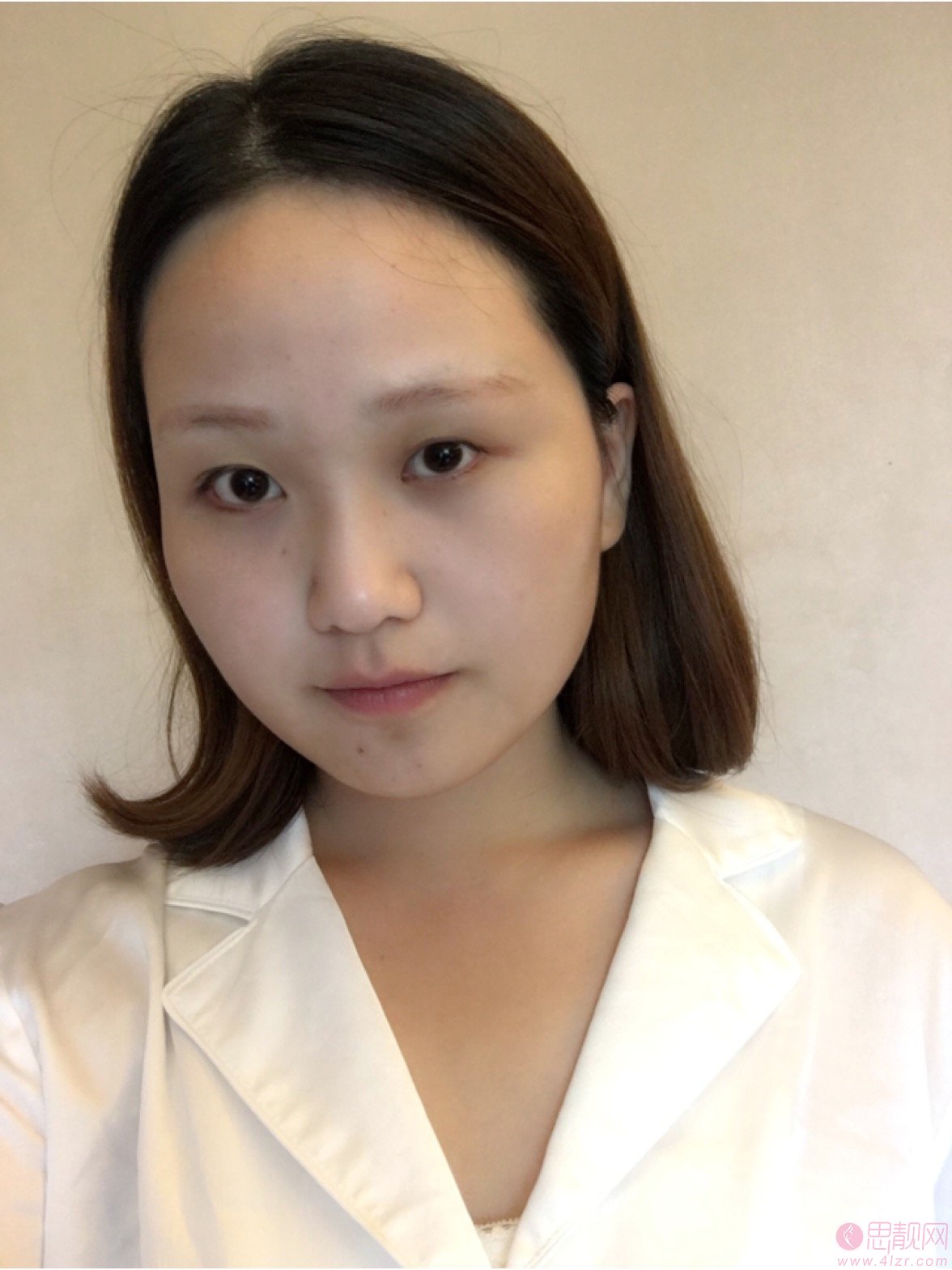 合肥双眼皮谁割得比较？附医生信息及案例+2020价格表一览