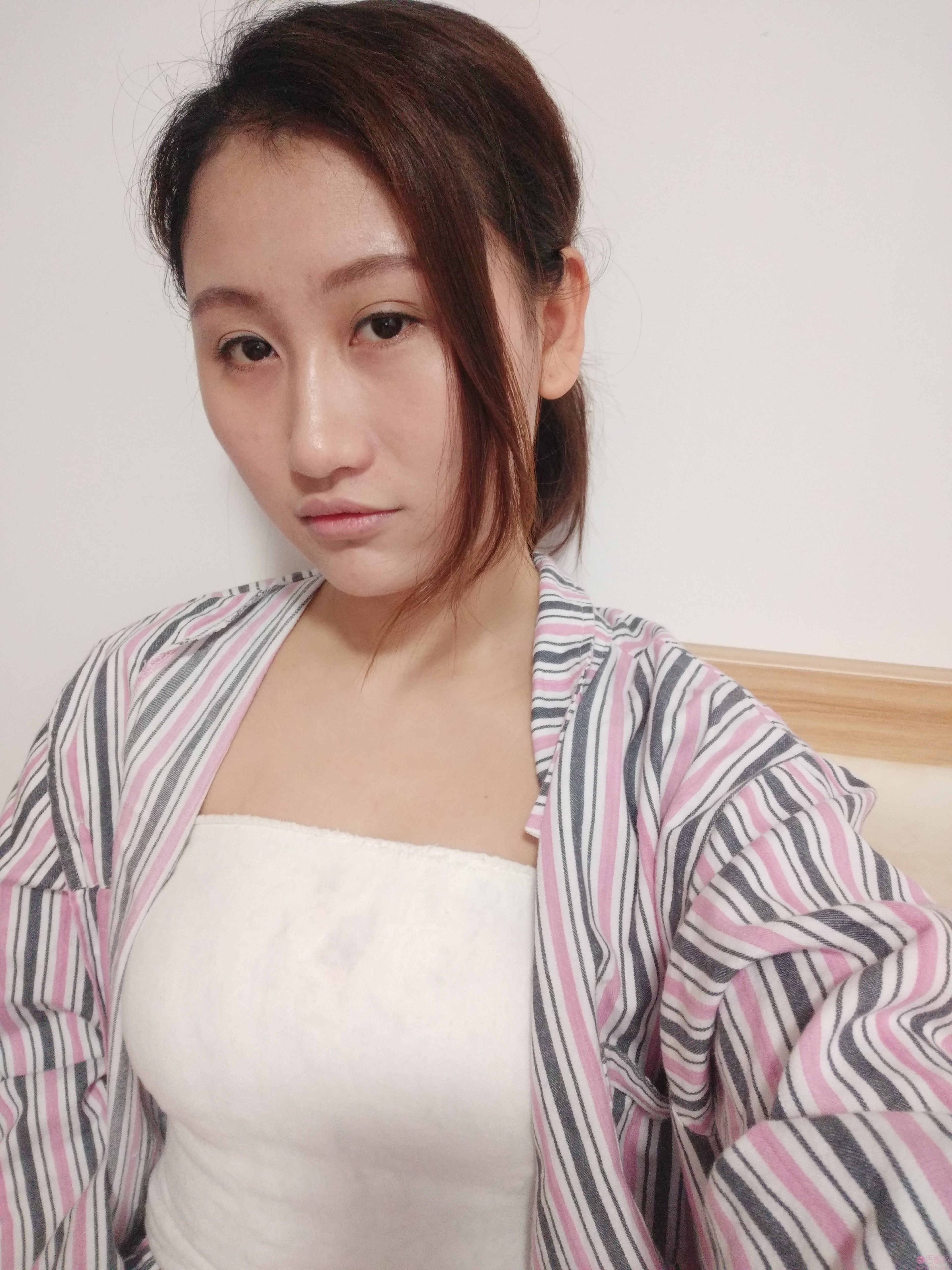 广州曙光医学美容医院江华教授隆胸如何？附隆胸真人案例及价格表明细一览