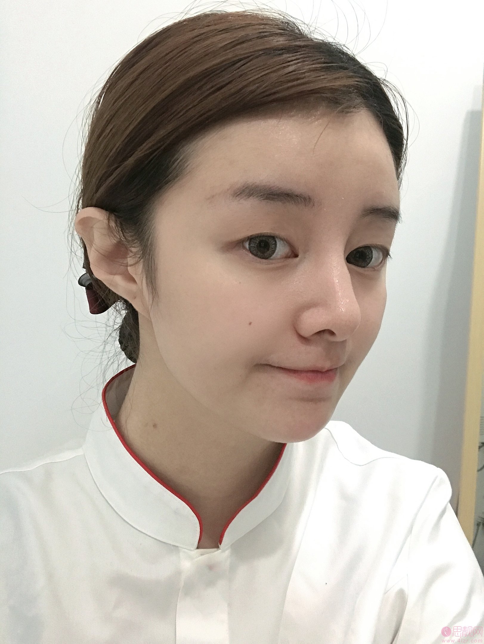 广州曙光整形吴毅平做双眼皮怎么样？附双眼皮真人案例及2020价格表一览