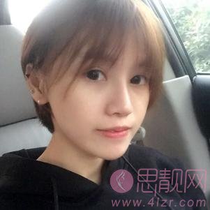 杭州美莱整形医院高士乾做双眼皮怎么样？附双眼皮案例及2020价格表公开