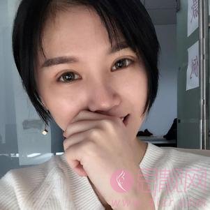 杭州美莱整形医院高士乾做双眼皮怎么样？附双眼皮案例及2020价格表公开