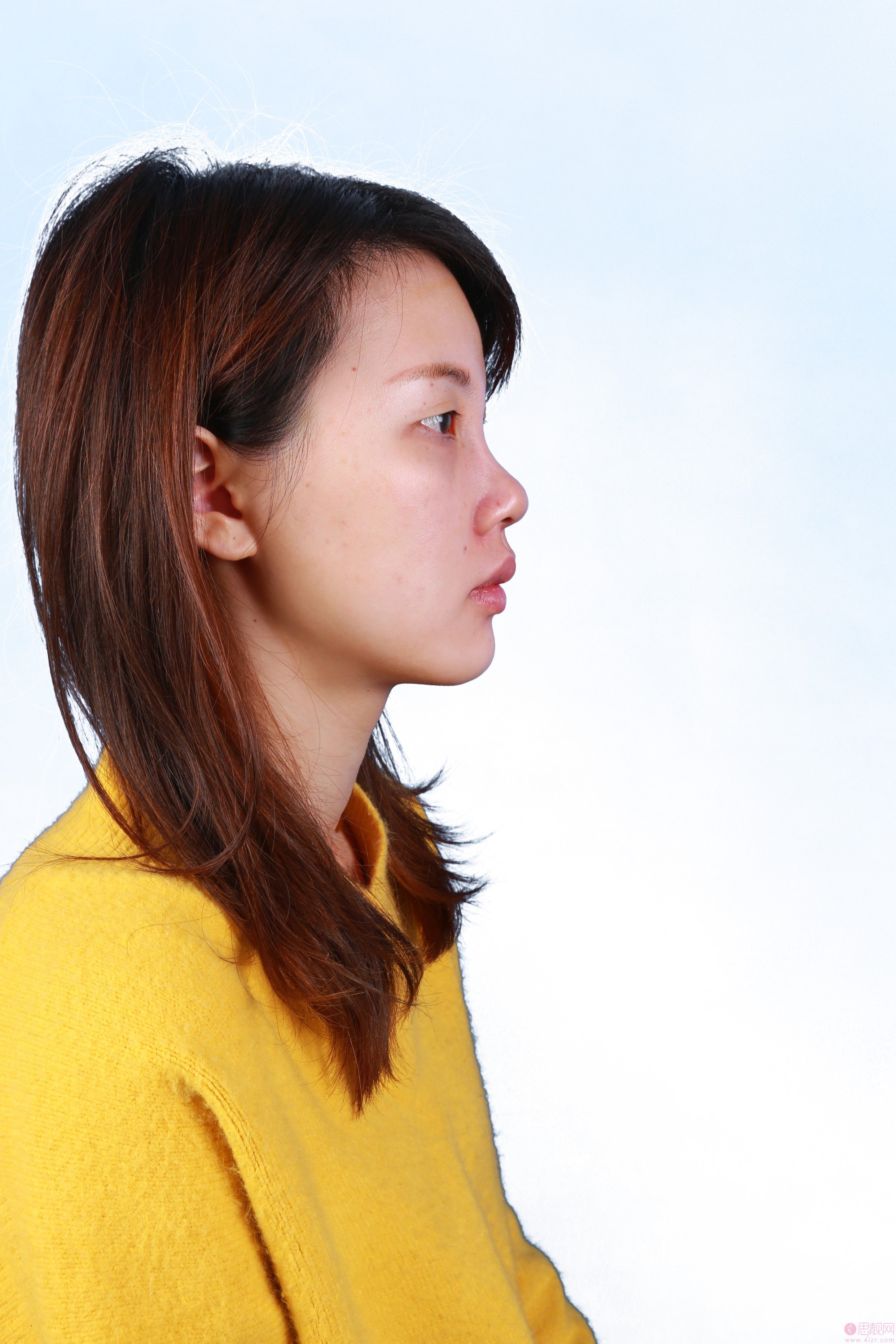 上海蝶可变医疗美容王志鹏做鼻子怎么样附隆鼻案例及2020价格表发布