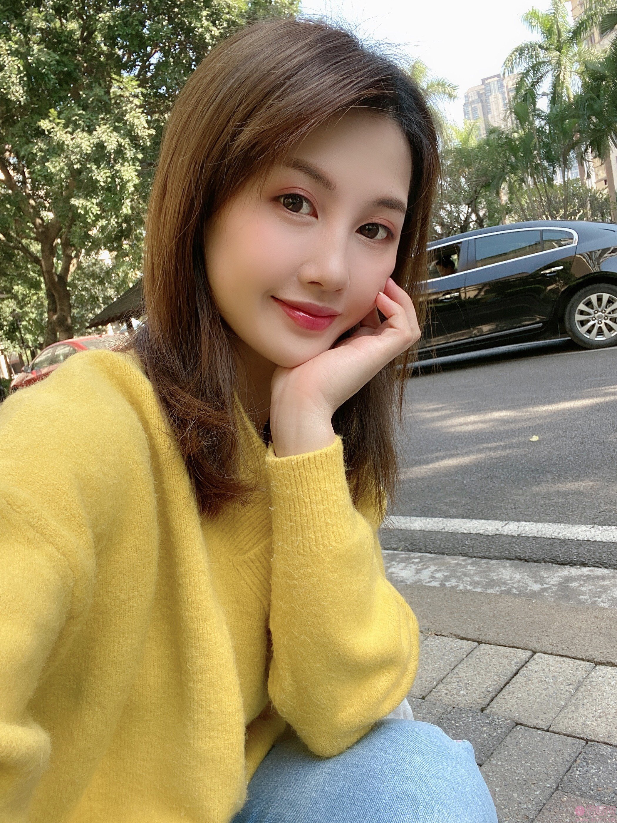 上海蝶可变医疗美容王志鹏做鼻子怎么样附隆鼻案例及2020价格表发布