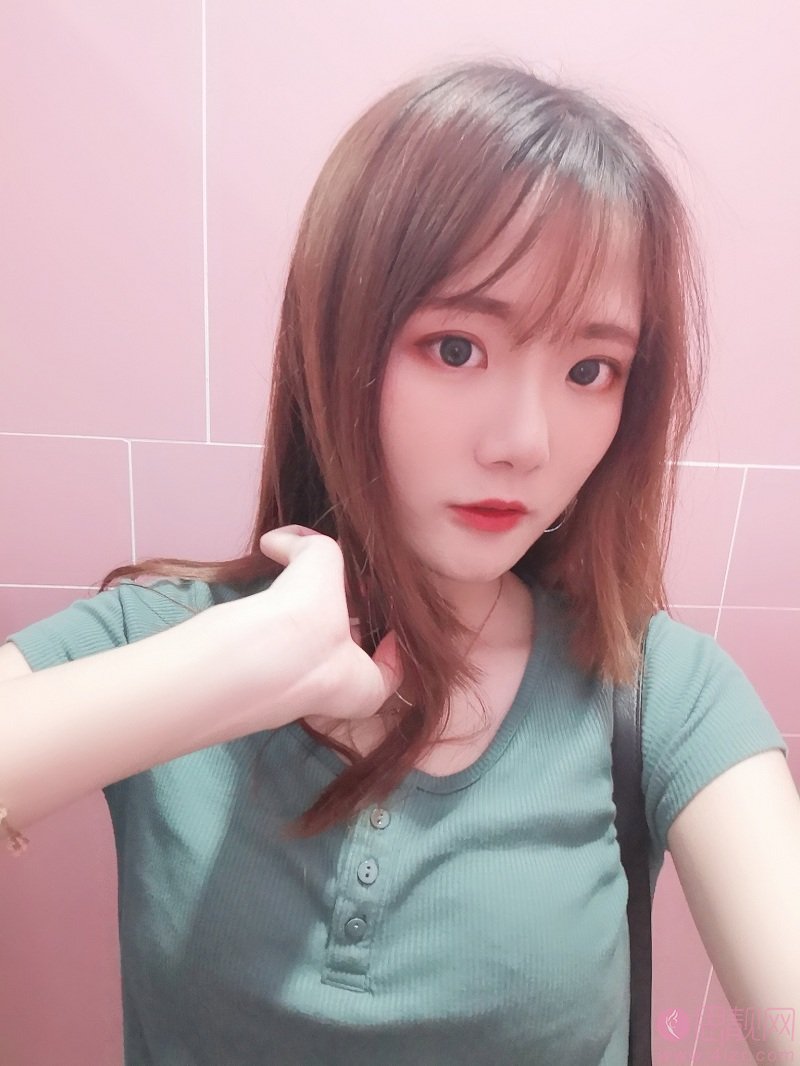 北京愉悦田秋梅隆鼻好不好？附隆鼻案例及价格表