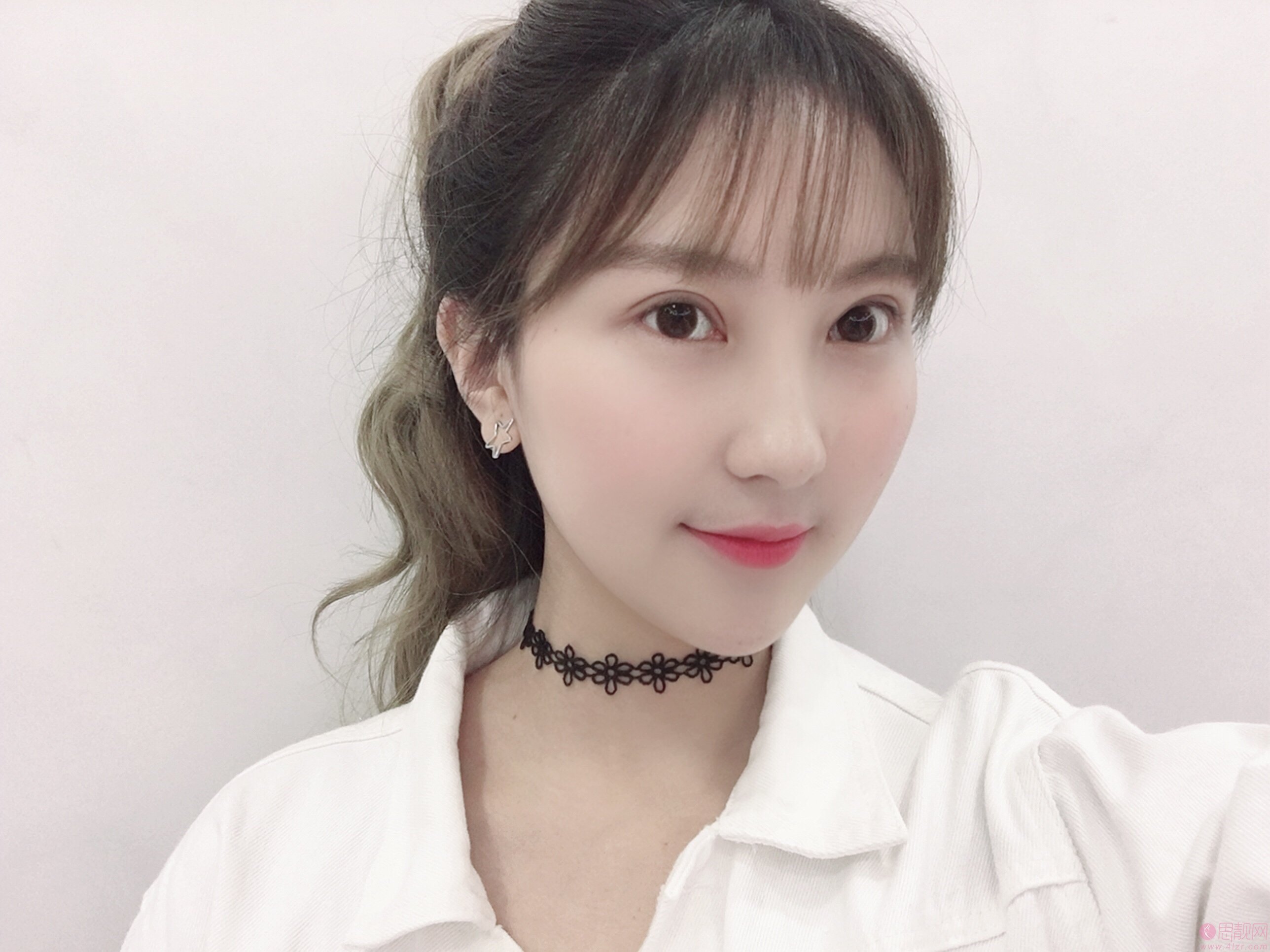 广州美莱陈贵宗做双眼皮如何?附案例恢复日记及2020价格表一览