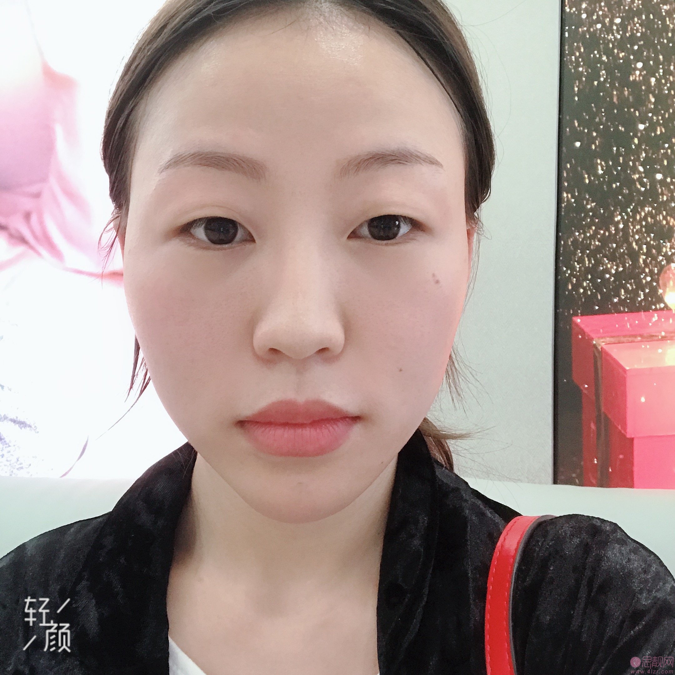 杭州时光吕敏做双眼皮怎么样？附双眼皮案例一览及2020价格表公开
