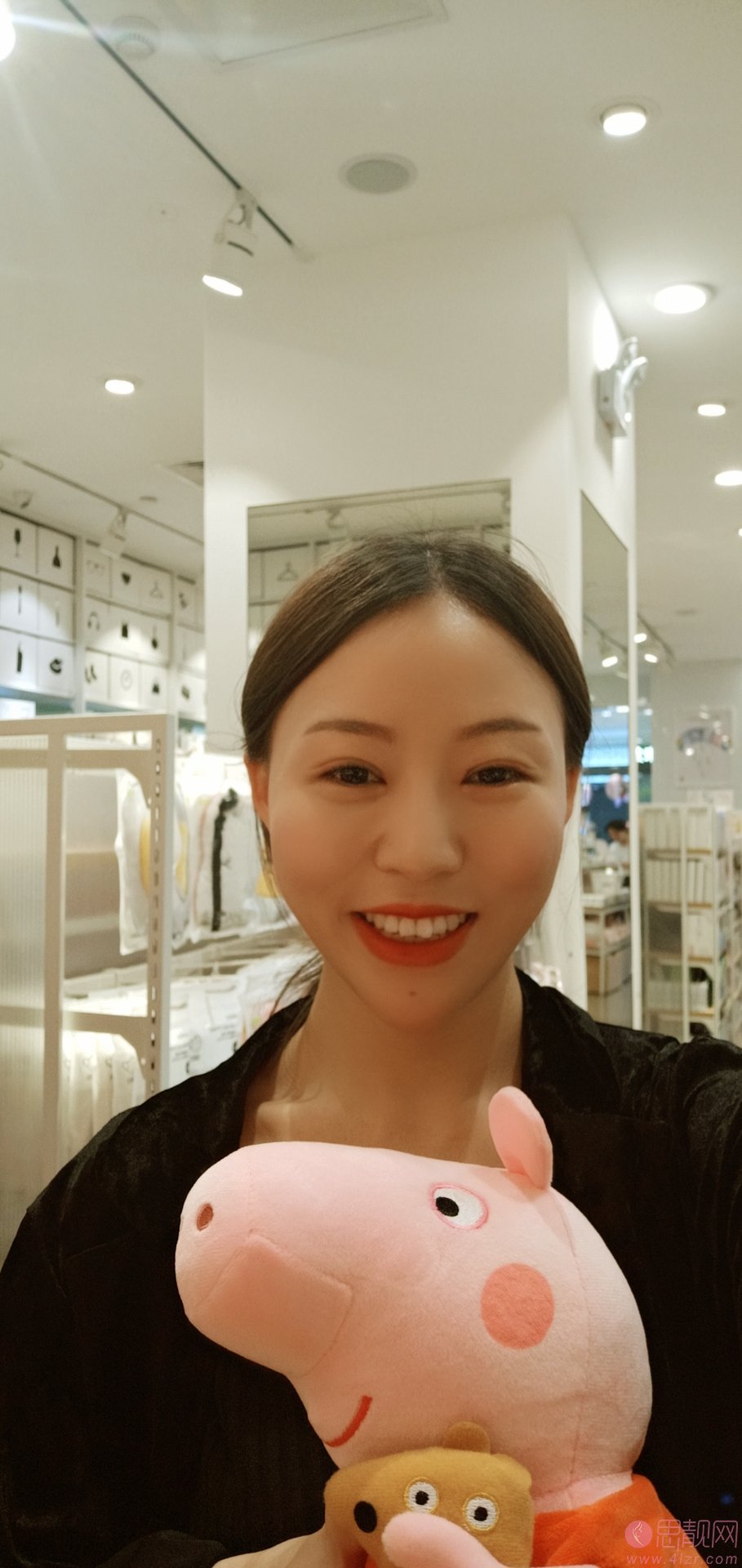 杭州时光吕敏做双眼皮怎么样？附双眼皮案例一览及2020价格表公开