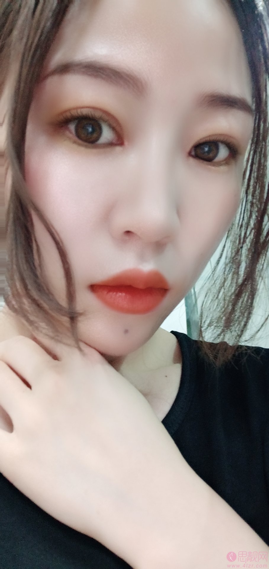 杭州时光吕敏做双眼皮怎么样？附双眼皮案例一览及2020价格表公开