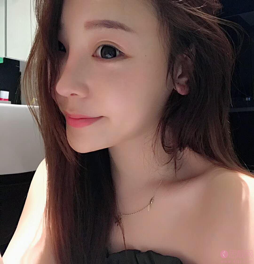 华美胡凯做鼻子如何？附隆鼻案例及2020价格表曝光