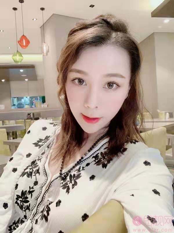 沈阳和平碧莲盛美学植发郎振图植发怎么样？附案例及价格表查询