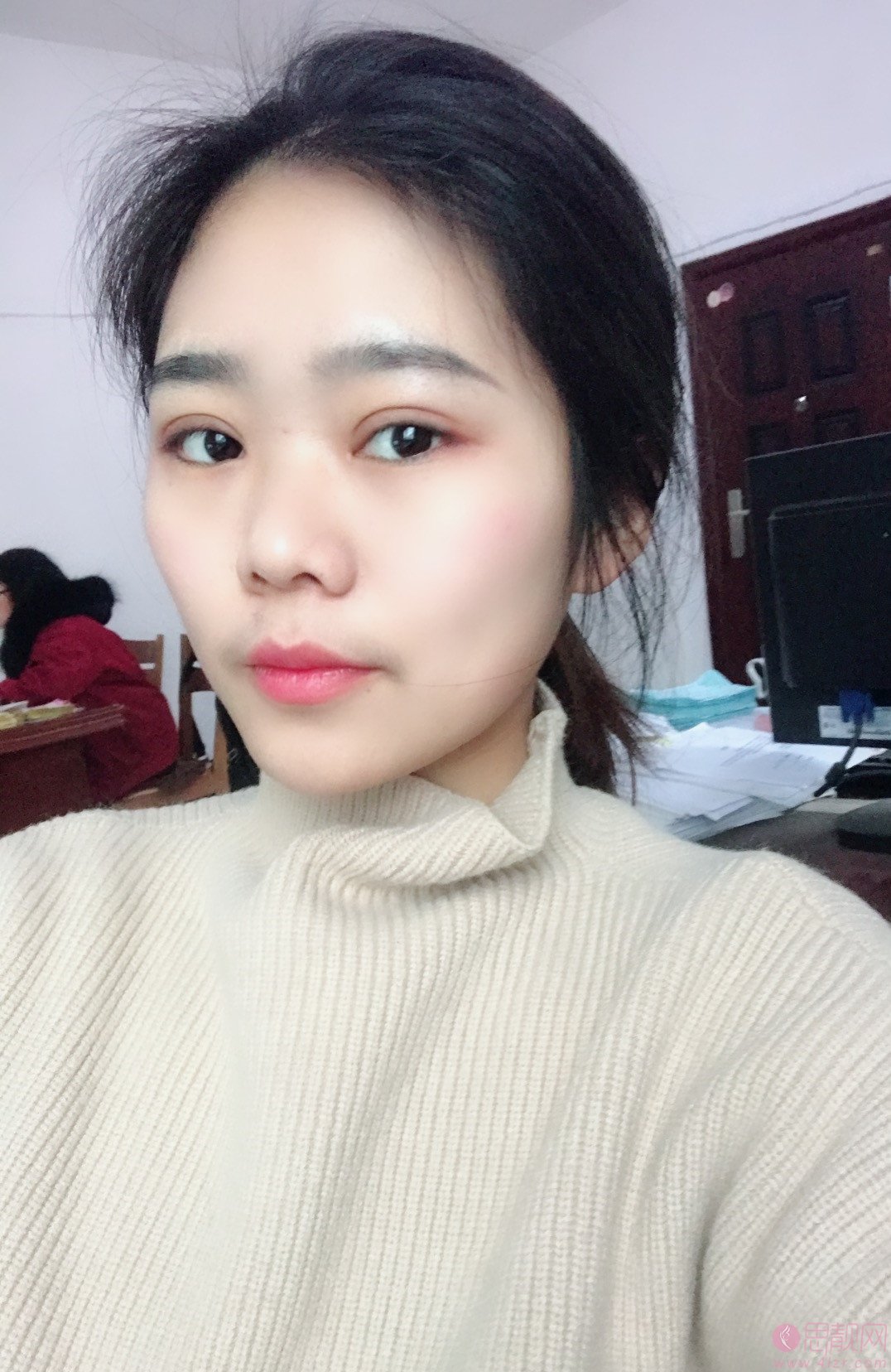 陕西省友谊医院整形外科张洁做双眼皮怎么样？附双眼皮案例及2020价格表曝光