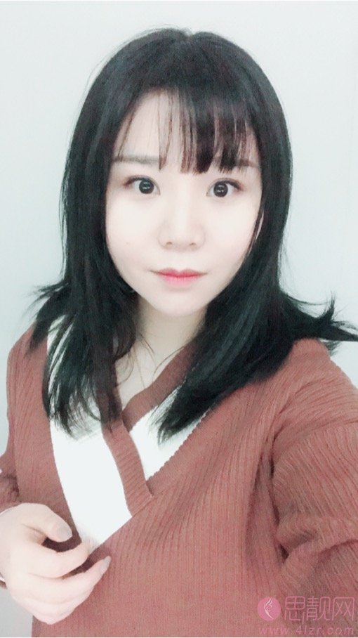 石杭燕做双眼皮怎么样?附双眼皮案例一览及2020价格表曝光