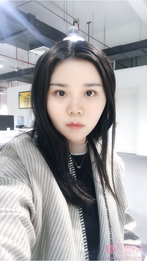 石杭燕做双眼皮怎么样?附双眼皮案例一览及2020价格表曝光