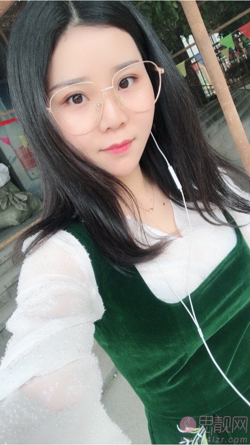 石杭燕做双眼皮怎么样?附双眼皮案例一览及2020价格表曝光