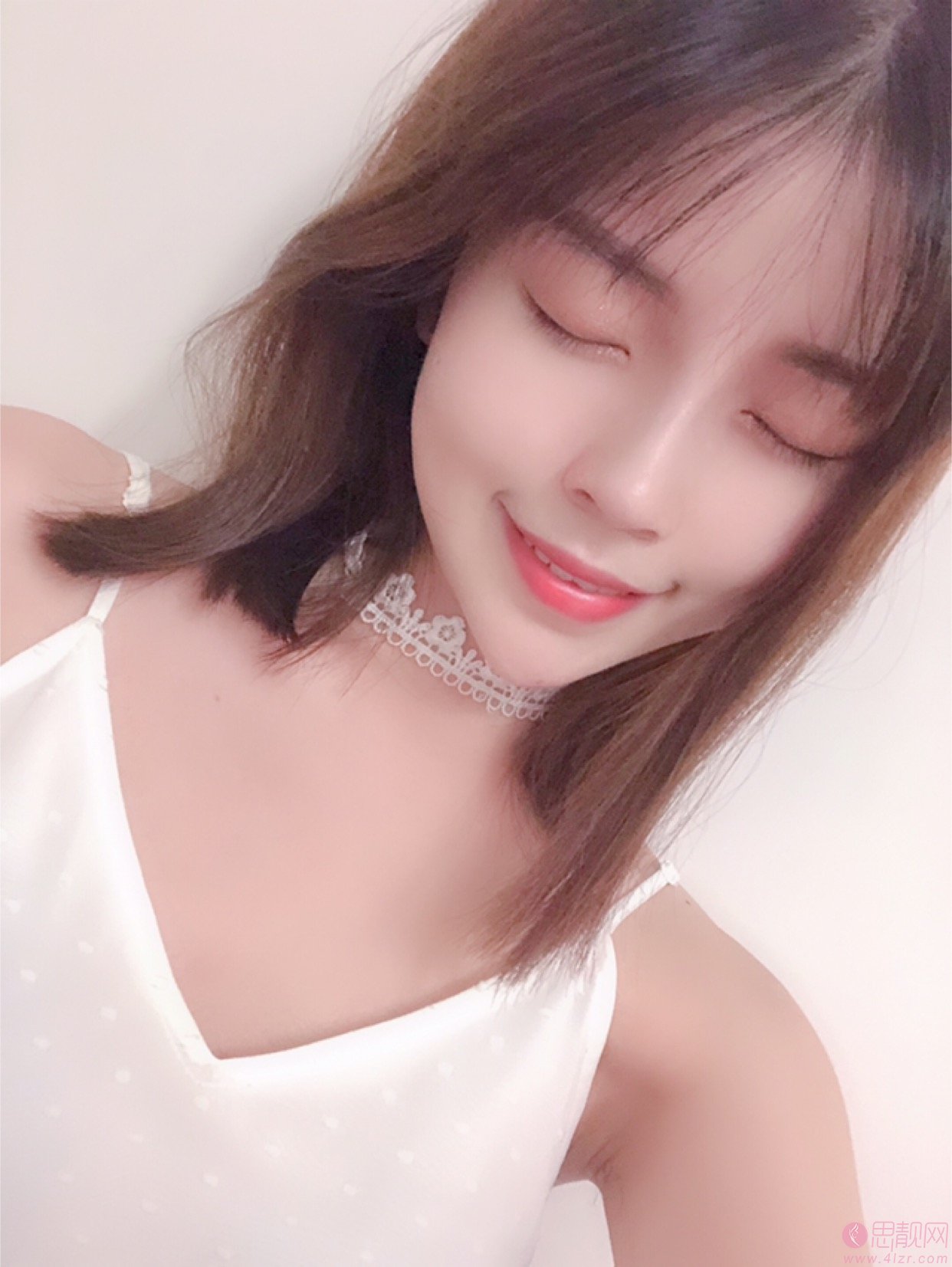 上海美莱整形医院陈玉连隆鼻如何、附隆鼻真人案例反馈及2020价格表发布