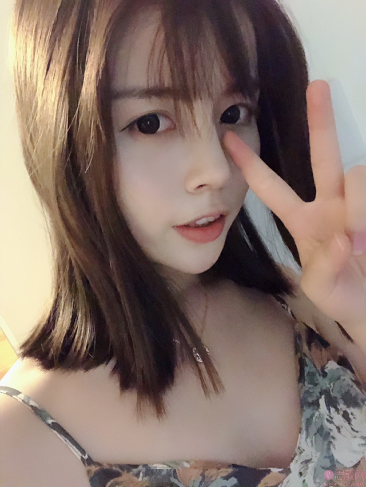 上海美莱整形医院陈玉连隆鼻如何、附隆鼻真人案例反馈及2020价格表发布