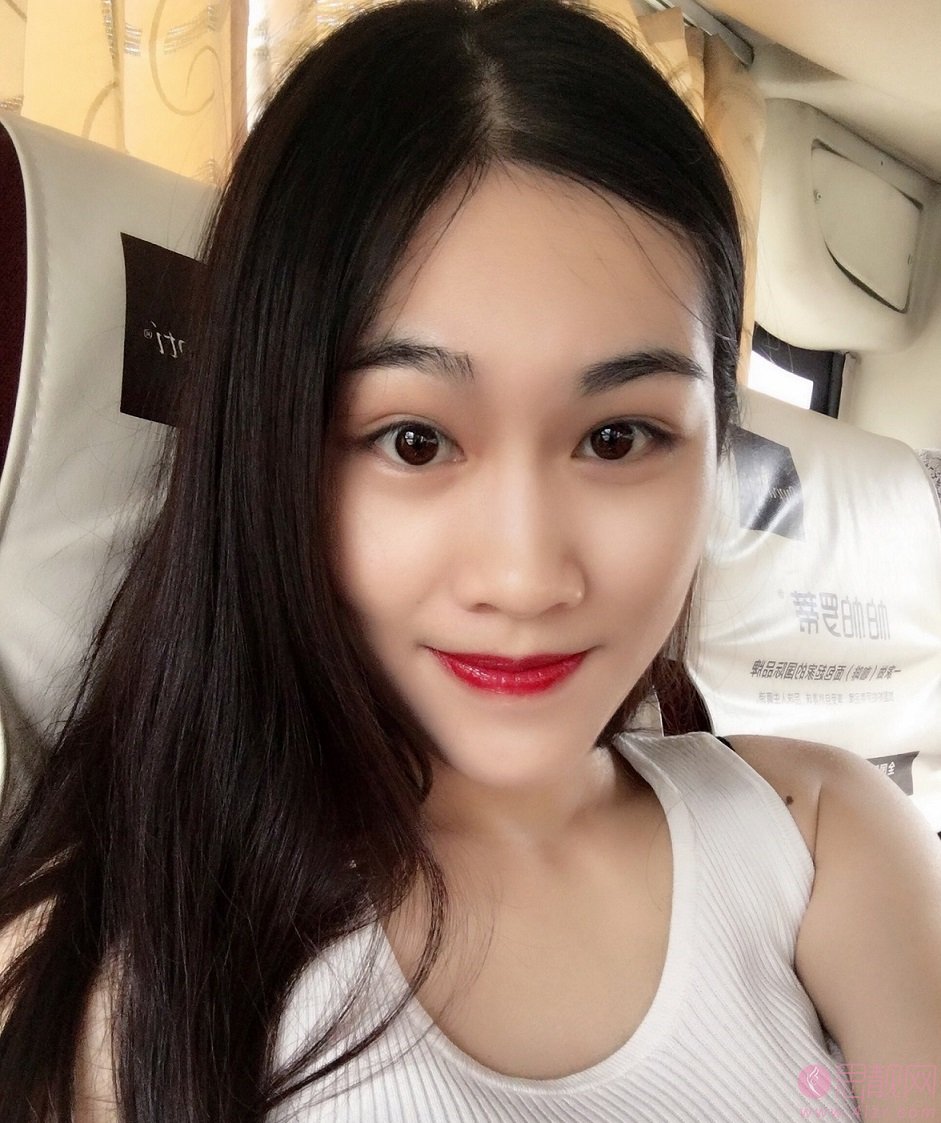 上海新形象的宣瑞军主任祛眼袋技术如何呀？附祛眼袋真人案例反馈及2020价格表曝光