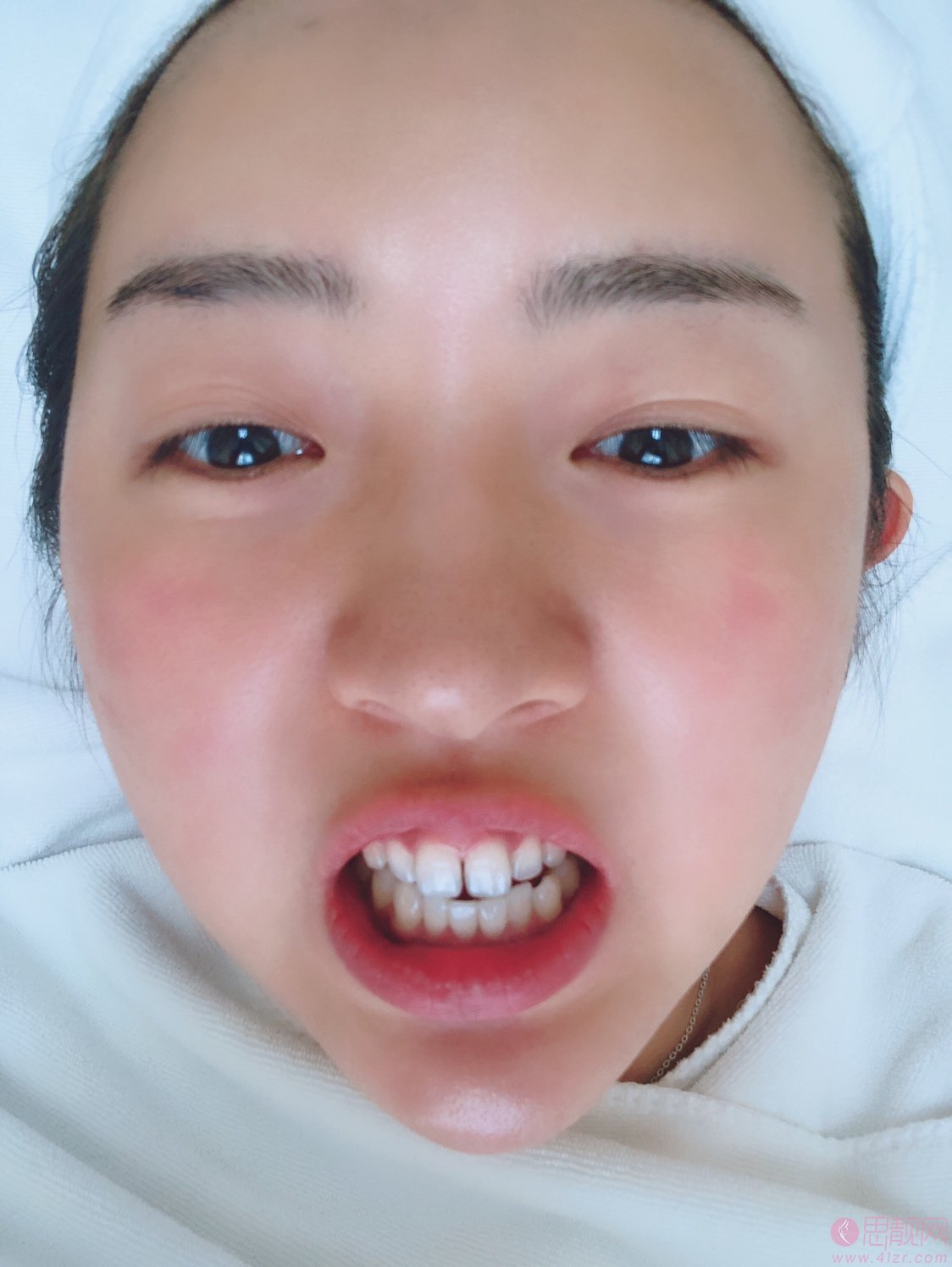 拜博口腔和美奥口腔哪个好?附矫正案例及2020价格表一