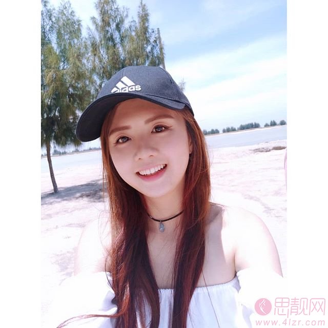 上海雅圣口腔做烤瓷牙怎么样?附案例一览+2020价格表发布