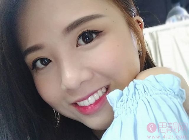 上海雅圣口腔做烤瓷牙怎么样?附案例一览+2020价格表发布