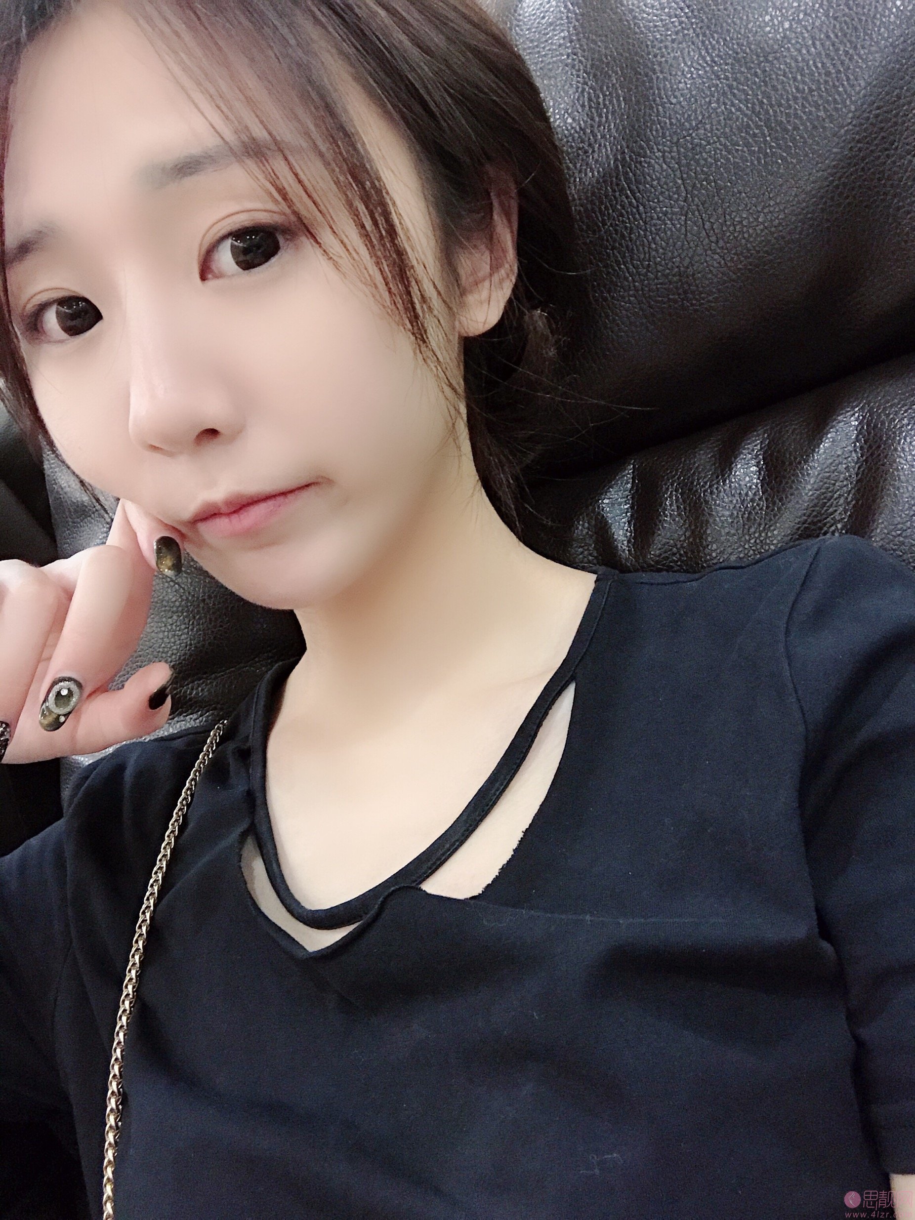 广州华美阮庆玲做双眼皮怎么样？附双眼皮真人案例分享+2020价格表曝光