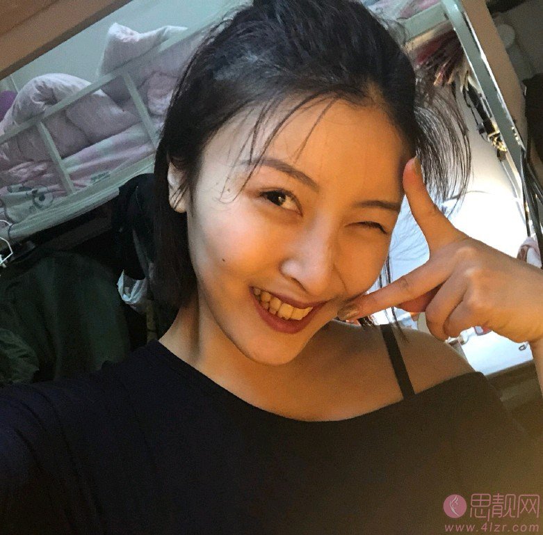 北仑人民医院口腔科洗牙多少钱？附洗牙案例分享+2020价格表公布