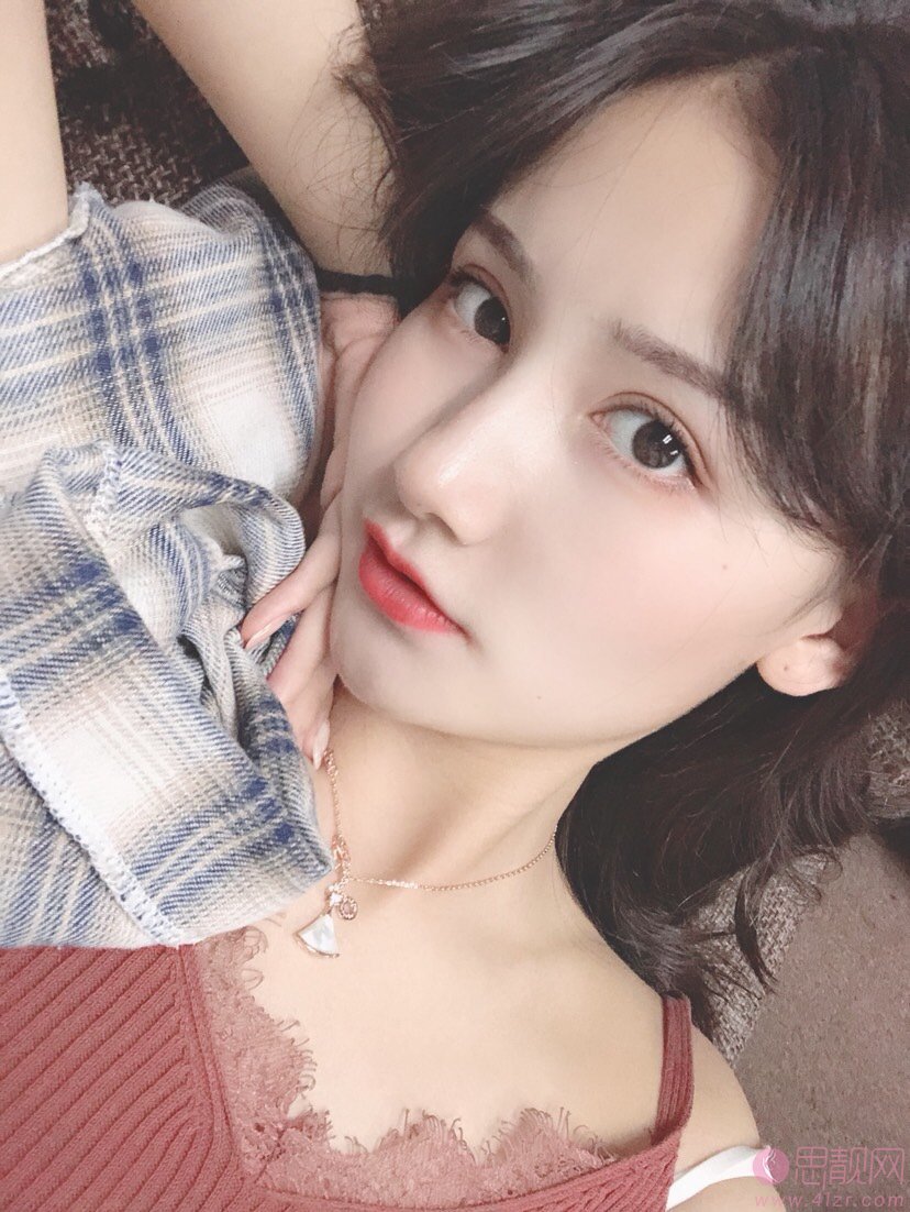 成都银海医美何军做双眼皮如何？附双眼皮案例及2020价格表一览
