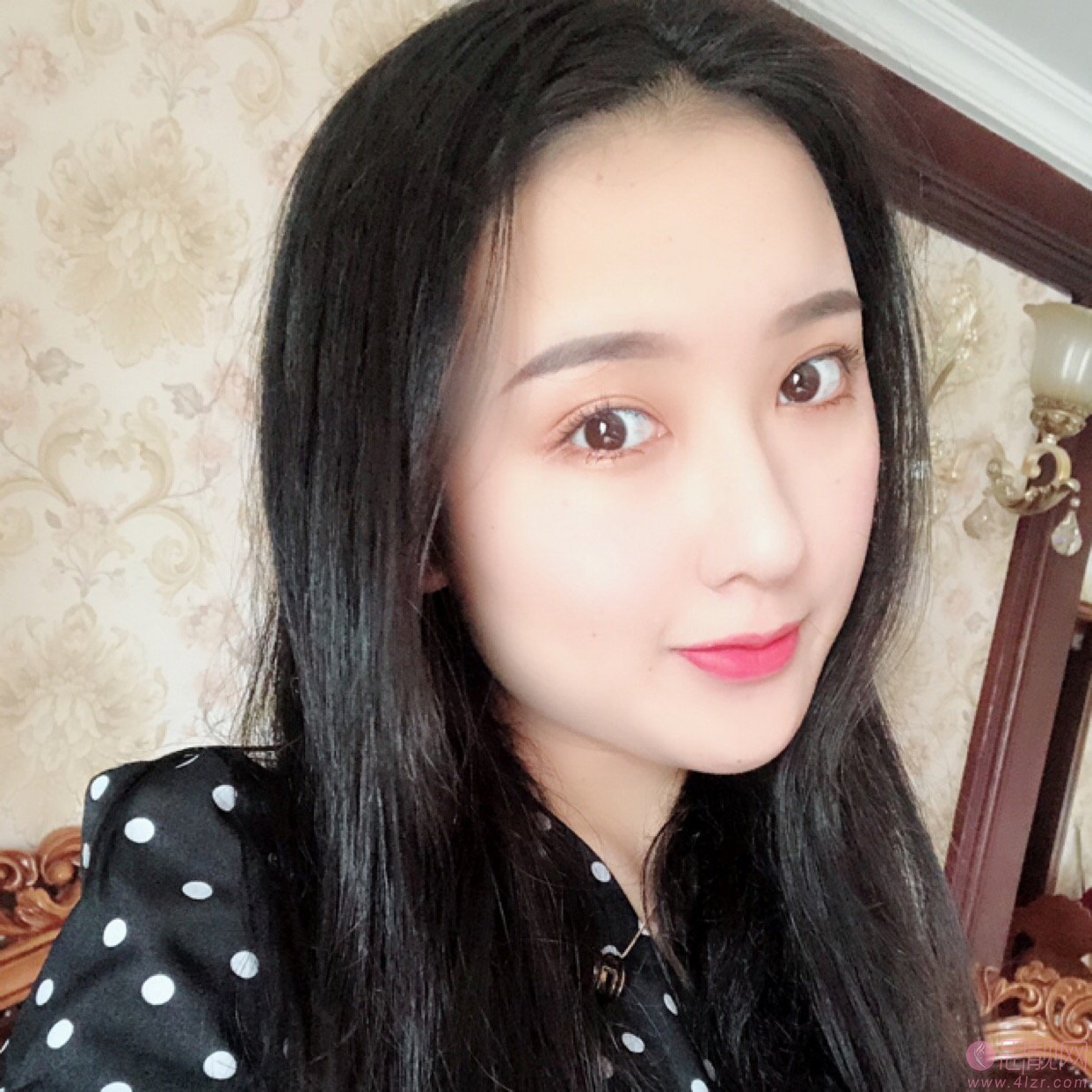 屈兴明医生做双眼皮如何？附2020价格表一览+双眼皮案例