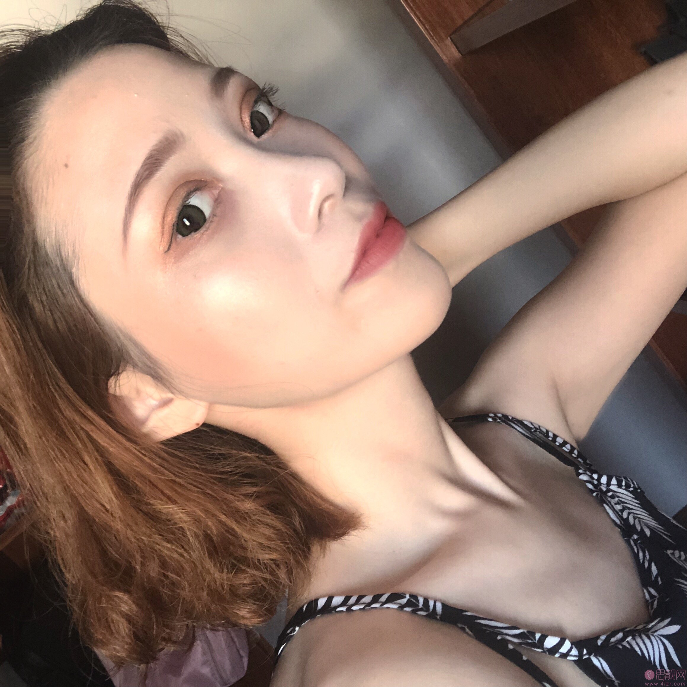 上海薇琳张怀军做的双眼皮好不好?附双眼皮真人案例反馈+2020价格表曝光