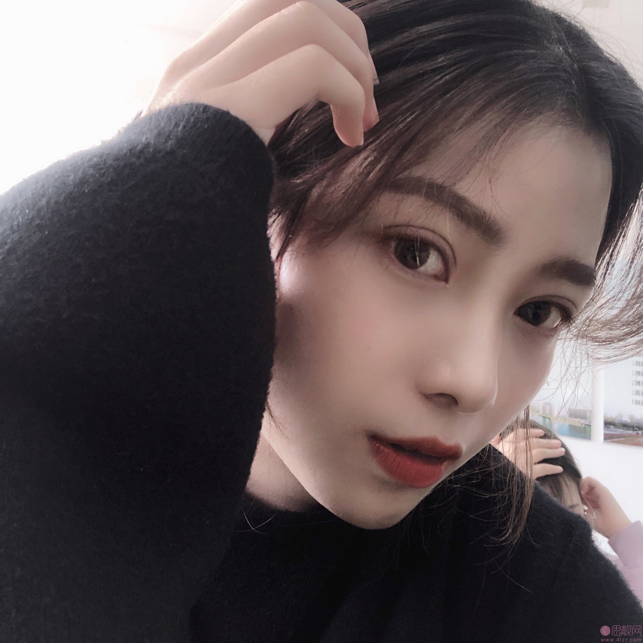 上海薇琳张怀军做的双眼皮好不好?附双眼皮真人案例反馈+2020价格表曝光