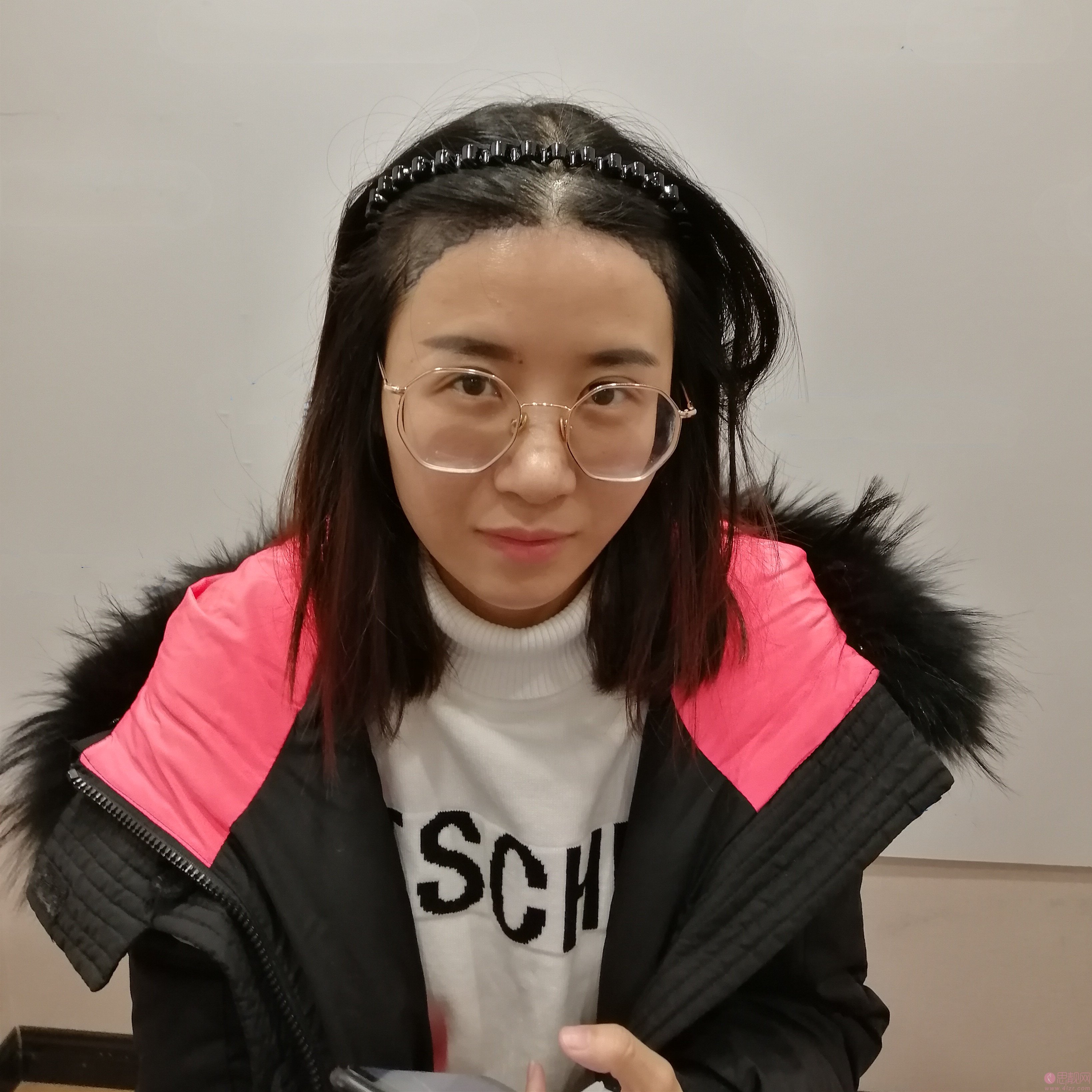 杭州雍禾植发张东宏植发怎么样？附植发案例一览