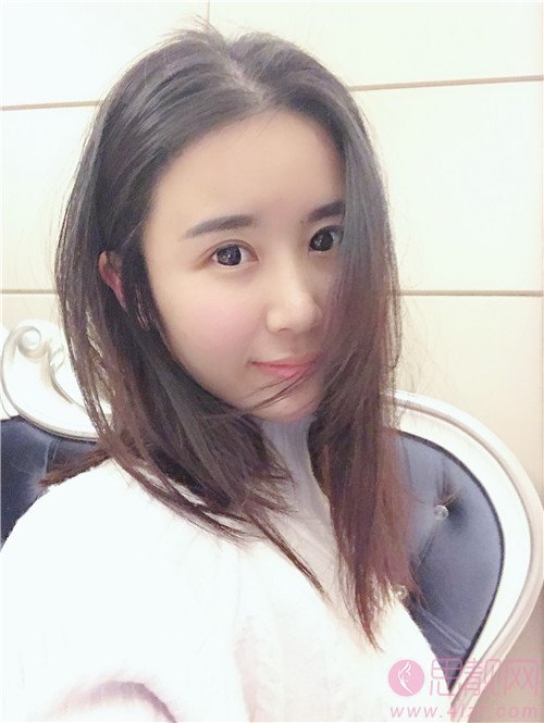 杭州雍禾植发张东宏植发怎么样？附植发案例一览