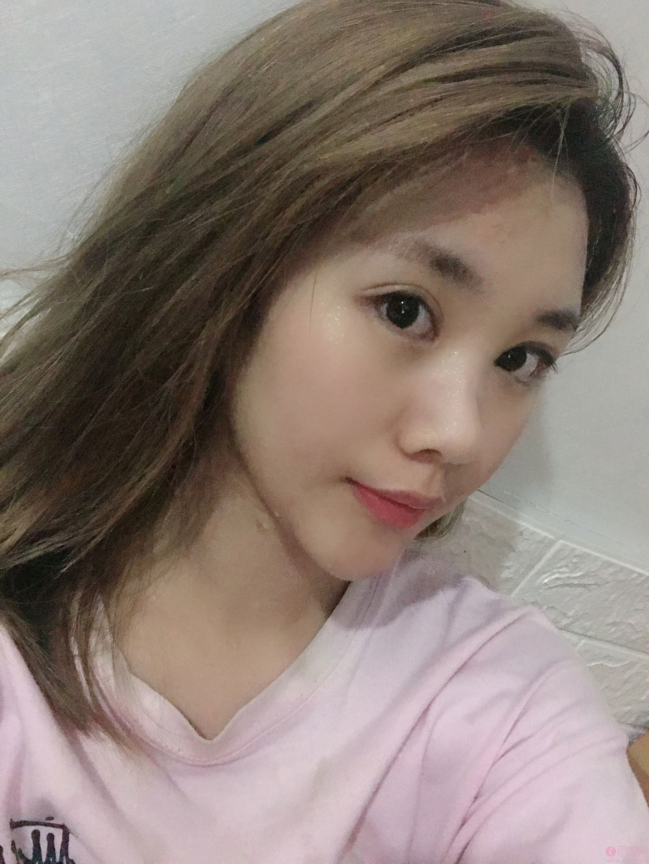 深圳美莱梁晓健做鼻子怎么样？附隆鼻真人案例反馈+2020价格表曝光