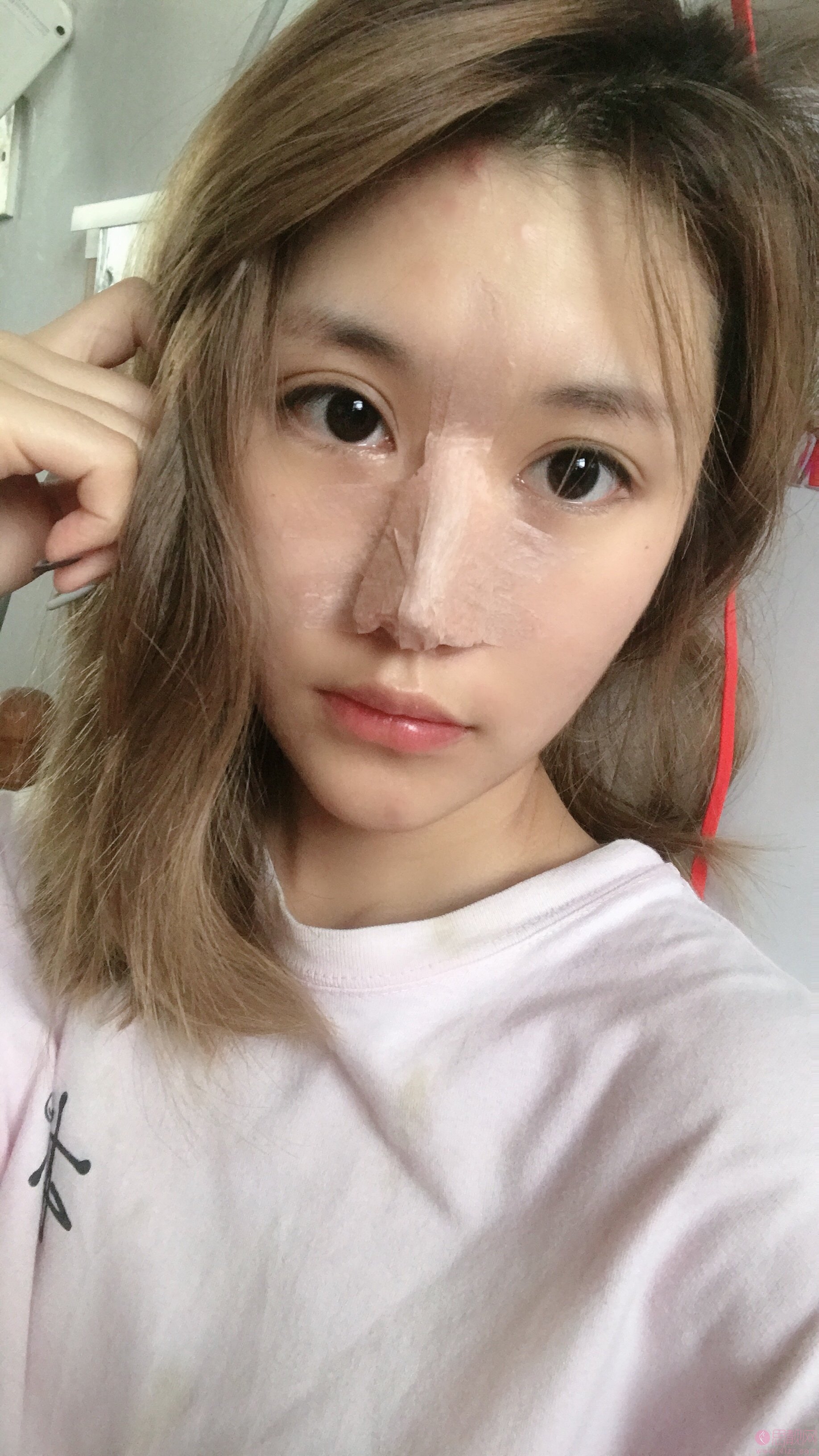 深圳美莱梁晓健做鼻子怎么样？附隆鼻真人案例反馈+2020价格表曝光