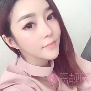民航上海医院俞良钢医生磨骨怎么样?附磨骨真人案例反馈及2020价格表一览