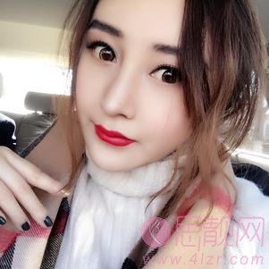 上海长征医院刘安堂隆鼻如如何？2020价格表明细一览+隆鼻真人案例分享