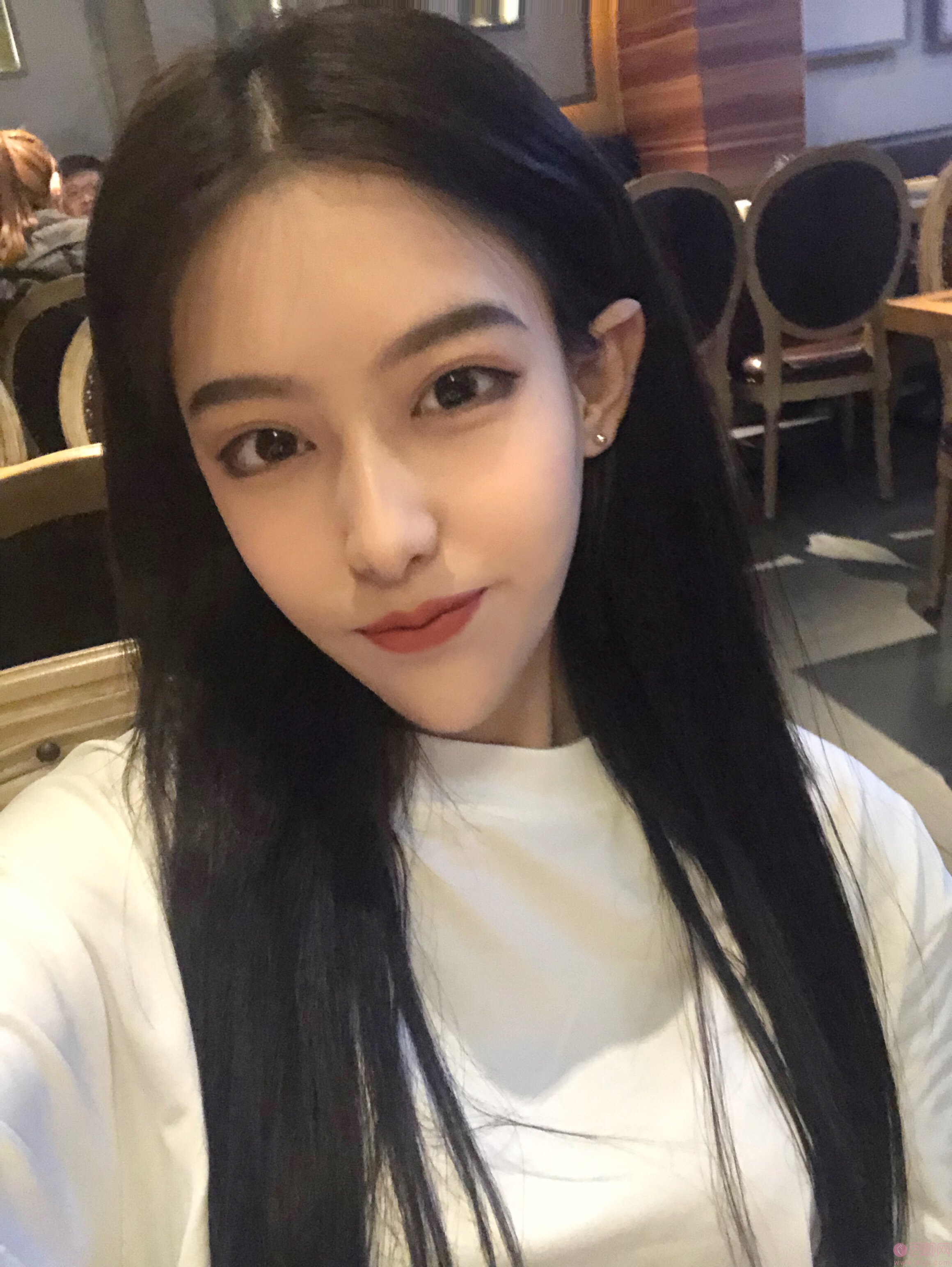 保定蓝山杜建龙做自体脂肪填充得怎么样？附案例分享及2020价格表一览