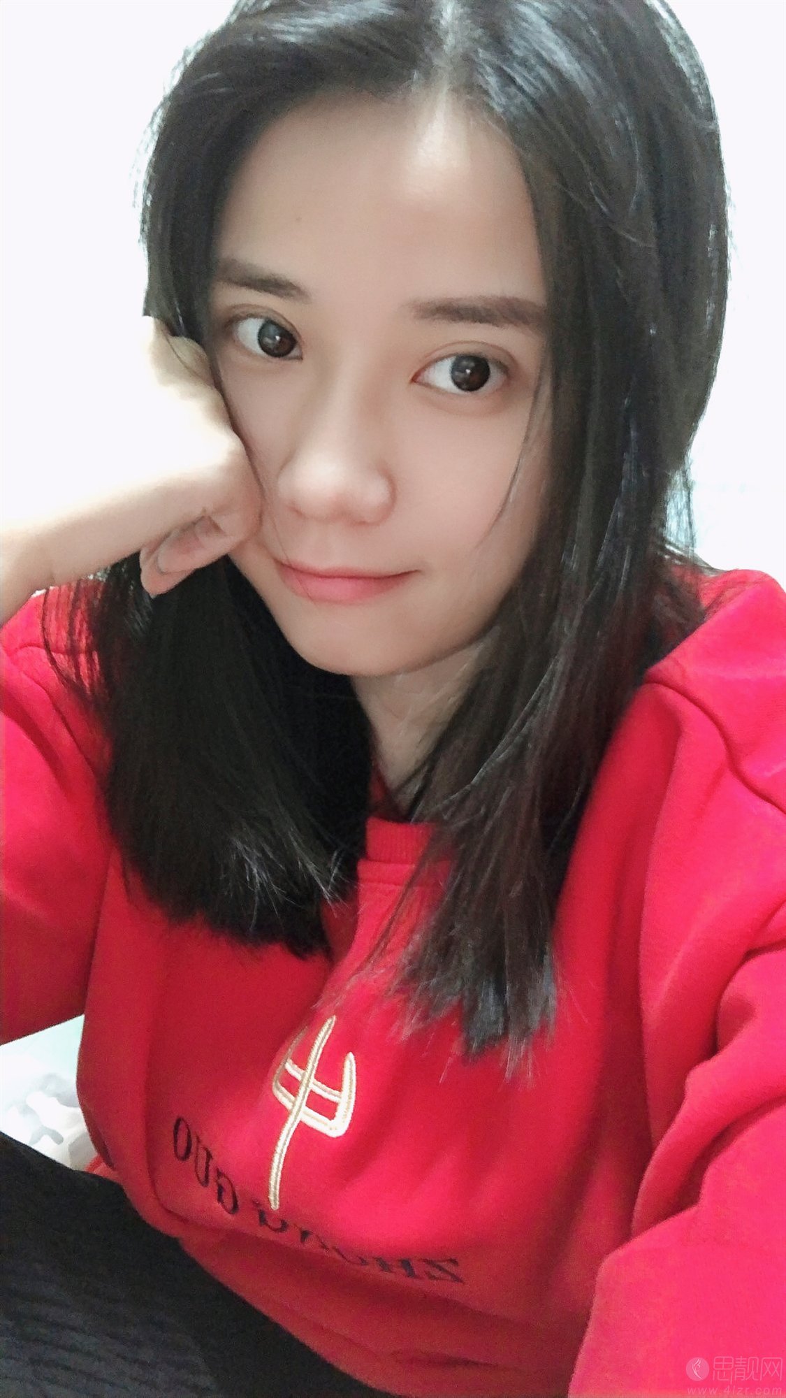 北京韩啸白永辉做双眼皮修复怎么样?附眼修复真实案例展示+2020年价格表一览