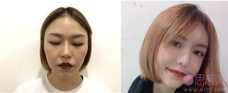 成都八大处整形