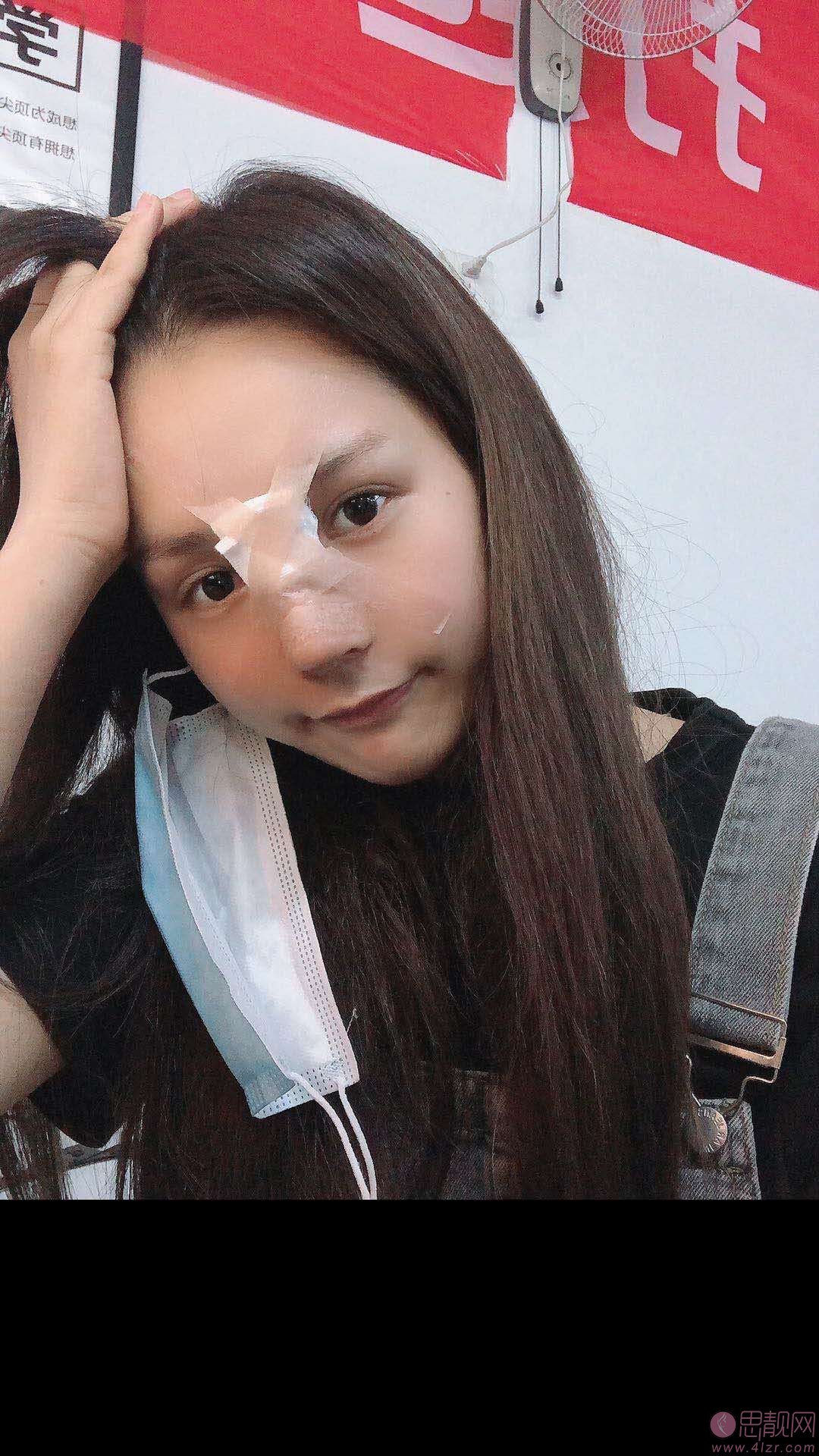 西安美立方美容医院怎么样?从口碑隆鼻案例看医院