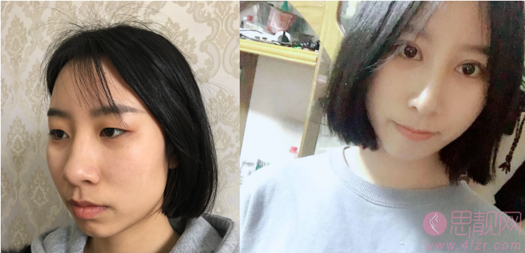 广州南方医院整形科