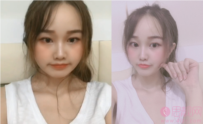 西安西京医院整形美容科