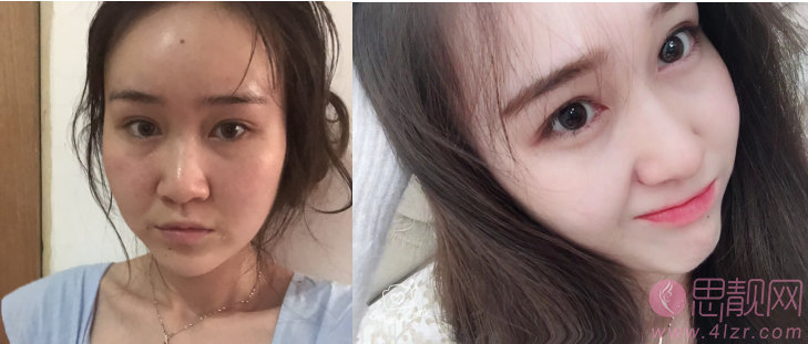 西安西京医院整形美容科