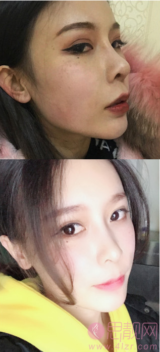 北京301整形