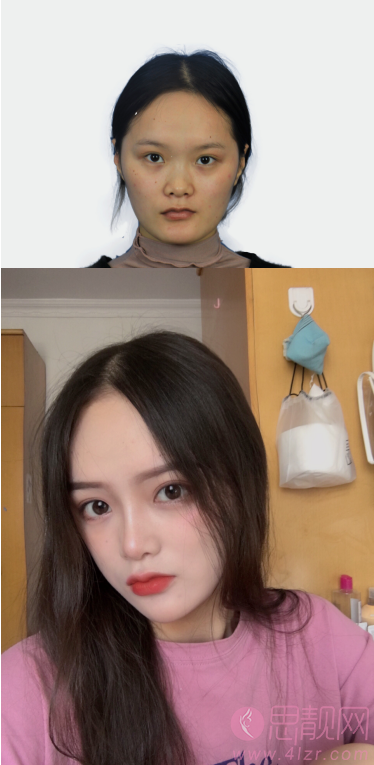 北京大学深圳医院整形